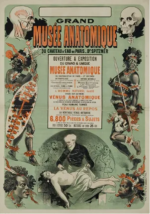 Cartel publicitario del Museo anatómico del Dr. Spitzner